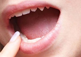 5 Tips Menjaga Kesehatan Lidah yang Jarang Kita Ketahui