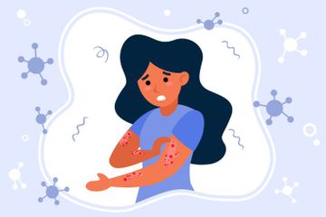 Sumber utama cacar monyet adalah hewan-hewan primata.
