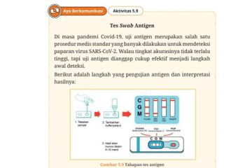 Tes swab antigen dilakukan untuk mendeteksi virus saat pandemi COVID-19.