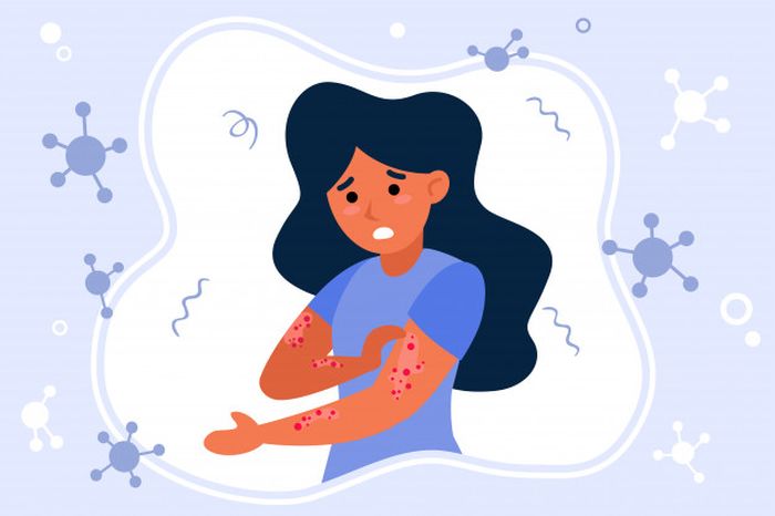 Gangguan pada kulit termasuk reaksi alergi tubuh contohnya eksim.