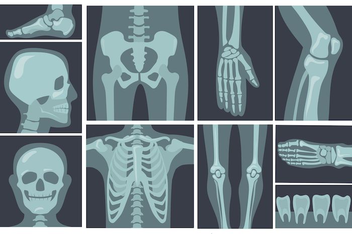 Hubungan antar tulang yang membentuk sendi kaku adalah hubungan antara
