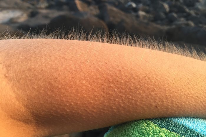 Pernahkah Kamu Merasakan Bulu Kuduk Merinding Saat Merasa Takut? Fenomena Ini Ternyata Memiliki Penjelasan Ilmiah Lho, Simak Yuk!