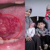 Belajar dari Andrie K Farid yang Meninggal Karena Kanker Lidah, Sang Istri Ngaku Nyesel Tak Larang Suami Konsumsi Makanan yang Jadi Penyebabnya Ini