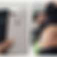 Kondisi Remaja Penjual Ginjal Rp 245 Juta Demi Beli iPhone Memprihatinkan