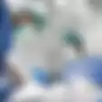 Heboh #OplasChallenge, Beginilah Sosok Pria Pertama Kali di Dunia yang Operasi Plastik