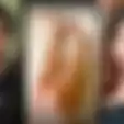 Ayu Thalia, Diduga Korban Penganiayaan Nicholas Sean Tunjukkan Foto Luka-luka di Kaki
