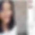 Foto Jadul Calon Istri Kaesang Pangarep Terbongkar, Pakai Kawat Gigi dan Wajah Polosan Tanpa Makeup