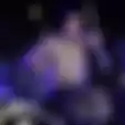 Travis Barker Bakal Jalani Operasi Jari Sebelum Berangkat Konser Nanti