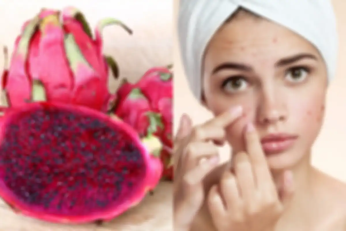 Manfaat buah naga untuk kecantikan, salah satunya bantu kurangi jerawat.