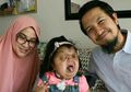 Mengenal kondisi Pfeiffer Syndrome type 2 yang Diderita Si Kecil Bella