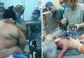 Kerahkan 16 Bidan dan Ahli Karena Kesulitan Tangani Persalinan Wanita Berberat 127 Kg, Beginilah Kondisi Bayi Itu Kemudian