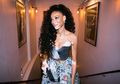 Winnie Harlow, Pengidap Kelainan Kulit. Tetap PD dan Cantik Mempesona
