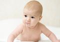 Gumoh Pada Bayi Adalah Hal yang Wajar, Begini Cara Mengatasinya