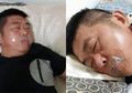 Suami Ini Rela Menutup Mulutnya dengan Selotip Saat Tidur, Ternyata Alasannya Bikin Terenyuh