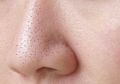 Niat Angkat Komedo, Perempuan Ini Menangis Tak Menyangka Alisnya Ikut Hilang