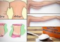 Cepat Hilangkan Lemak Perut, Lengan, dan Punggung dengan Baking Soda