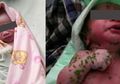 Ditemukan Mengapung di Tumpukan Sampah, Begini Kondisi Bayi yang Sempat Dikira Boneka!