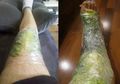Kubis Ternyata Efektif Usir Nyeri di Persendian, Caranya Mudah dan Murah