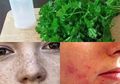 Yang Terjadi Pada Kulit Setelah Rutin Cuci Muka dengan Ramuan Seledri