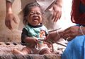 Pria 23 Tahun Ini Terperangkap di Tubuh Bayi, Dianggap Titisan Dewa