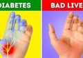 Mulai Diabetes Hingga Liver, Inilah Penyakit Berbahaya yang Dapat Dideteksi Lewat Tangan Anda