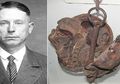 Mengerikan! Kepala Pembunuh Berantai Ini Dijadikan Mumi dan Dibelah Dua Oleh Dokter