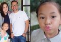 Belajar Dari Pengalaman Mona Ratuliu, Kenali Penyakit Pitiriasis Alba
