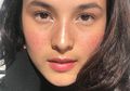 Chelsea Islan sampai BCL, 5 Artis Ini Rias Wajah dengan Freckles, Siapa Paling Cantik?