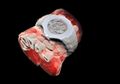 Kamu Wajib Lihat X-Ray 3D Berwarna Tubuh Manusia Pertama di Dunia Ini