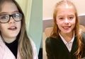 Buat Slime dari Tutorial Youtube, Anak Ini Malah Kena Luka Bahan Kimia