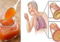 Minum Sirup Wortel 3 Sendok Setiap Hari Saat Kondisi Ini, Beberapa Hari Kemudian Anda Akan Merasakan Manfaatnya!