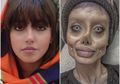 50 Kali Operasi Plastik Hingga Berat Badan Turun 40 Kg, Begini Kabar Penggemar Angelina Jolie Ini Sekarang: Ditangkap Polisi dan Ungkap Kehidupan Kelam