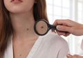 Cara Menghilangkan Tahi Lalat Pakai Bahan Alami, Murah Banget!