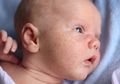 Merawat Kulit Bayi Sensitif Jangan Sembarangan Moms! Ini yang Harus Diperhatikan