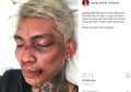 Young Lex Unggah Foto Babak Belur Dihajar K-Popers Garis Keras, Ternyata Semua Hanya HOAX