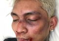 Young Lex Ngaku Dipukuli Fans Blackpink, Beneran Hoaks atau Sensasi?