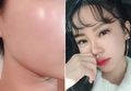 Ingin Kulit Glass Skin ala Perempuan Korea? Ini 5 Tips Cantiknya