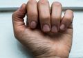Sering Alami Kesemutan di Tangan Bisa Saja Jadi Tanda Hipertensi hingga Penyakit Lain yang Ancam Kesehatan