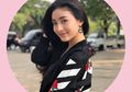 Natasha Wilona Tuai Pro Kontra saat Pamer Wajah Bermakeup Freckles, Kenapa?