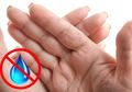 Awas, Pakai Hand Sanitizer Keseringan Bisa Sebabkan Permasalahan Kulit