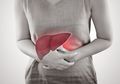 Jangan Sampai Terlambat! Tiga Ramuan Obat Rumahan ini Wajib Dicoba Karena Ampuh Cegah Penyakit Liver