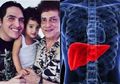 Faldy Albar Meninggal Akibat Penyakit Liver, Ini 8 Cara Melindungi Liver
