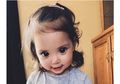 Meski Mata Anak Ini Terlihat Indah, Ternyata Ia Mengalami Sindrom Langka