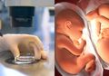 41 Tahun yang Lalu, Bayi Tabung Pertama di Dunia Lahir, Begini Sejarahnya