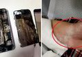 Tangan Perempuan Ini Terbakar Setelah Mencharge Ponsel Semalaman