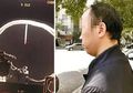 Dokter Temukan Paku Ukuran 4,8 cm di Kepala Pria yang Berulang Kali Mengeluh Sakit Kepala Ini, Mengerikan!