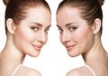 Cara Menutupi Jerawat dan Beruntusan dengan Makeup dari MUA Audrrey Nur Safira