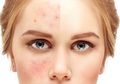 Deretan Tips Memilih Produk Untuk Kulit Sensitif
