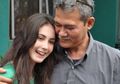 Penyebab Kematian Ayah Arumi Bachsin Bisa Jadi Karena 2 Penyakit Mengerikan Ini!