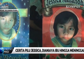 Meski Telah Dibakar oleh Sang Ibu, Bocah 10 Tahun Ini Tetap Doakan Ibunya Sebelum Meninggal, Haru!